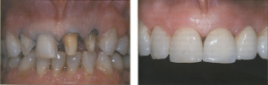 foto05